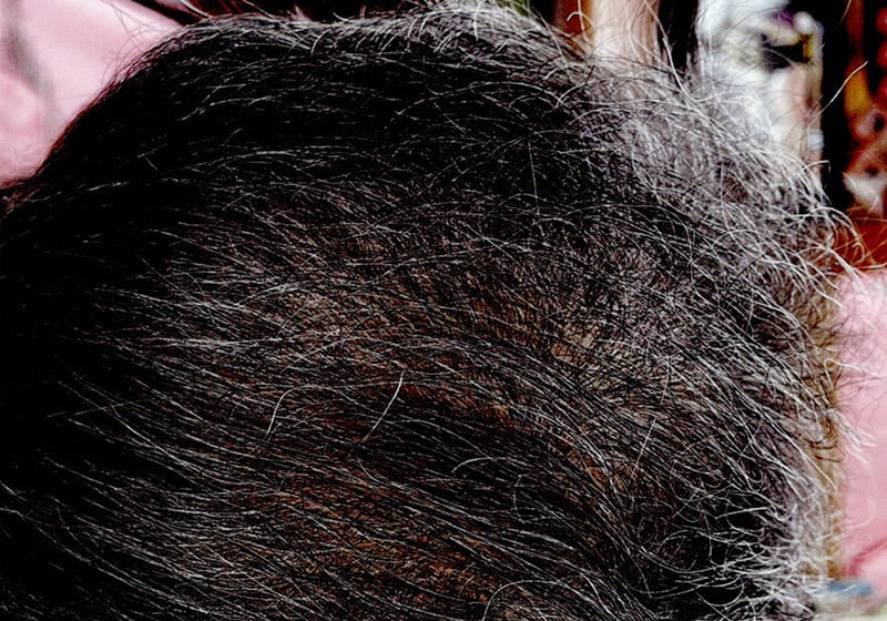 使用後（3ヶ月後）